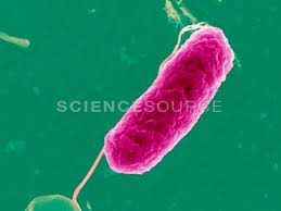 Plesiomonas shigelloides